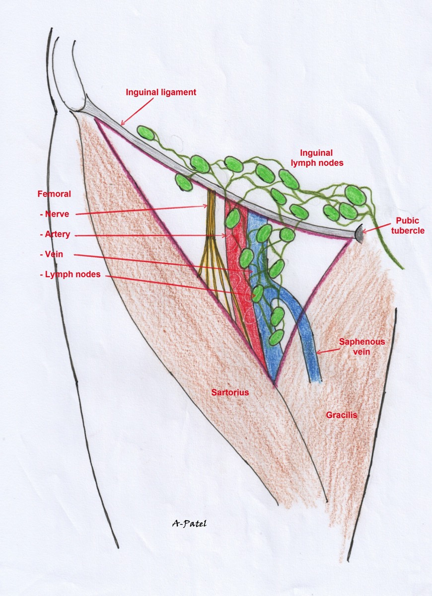 Schematic drawing of groin anatomy